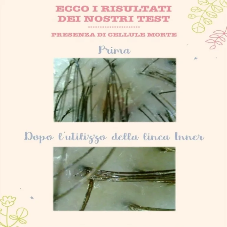 Lozione capelli detox e anti-forfora
