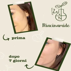 Niacinamide + Zinco